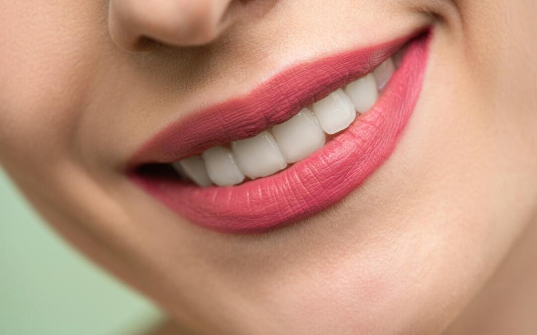 The Secrets of Dazzling Smiles: A Comprehensive Guide to Teeth Whitening