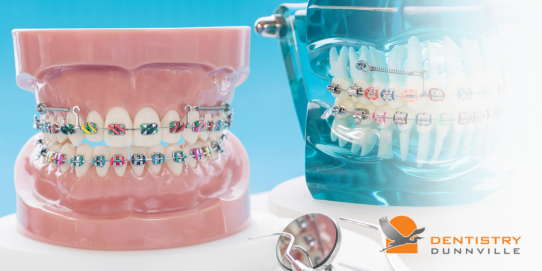 Braces at Dentistry Dunnville