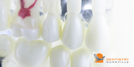 Root Canal Recovery: Tips for a Smooth Healing Process