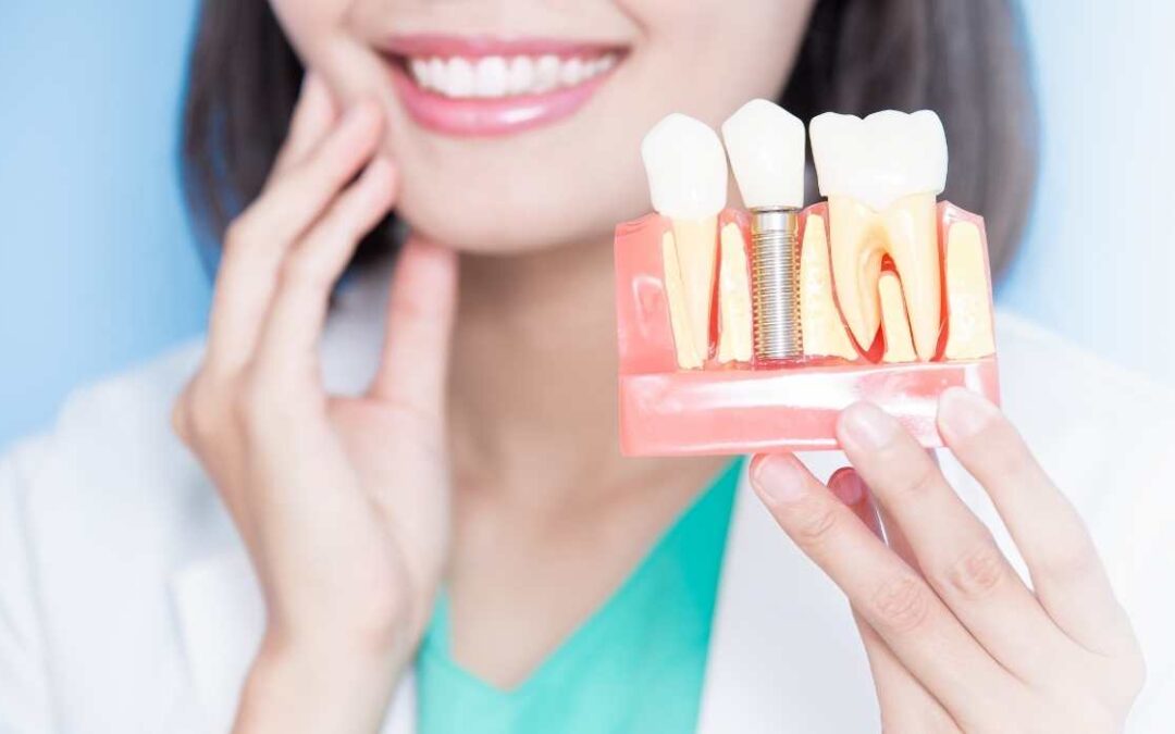 The Science Behind Dental Implants: How Osseointegration Works