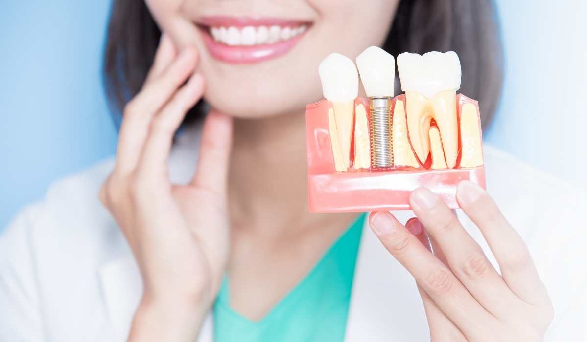 Dental implants osseointegration process illustrated by Dentistry Dunnville
