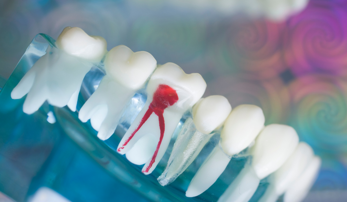 Root canal treatment consultation at Dentistry Dunnville