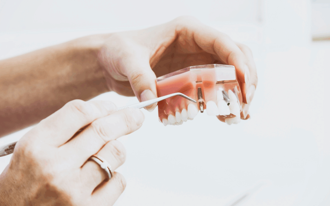 Dental Implants: Failure Prevention & Solutions