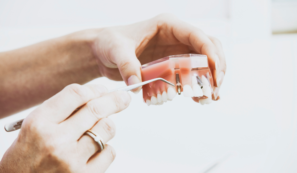 Dental implants failure prevention and treatment solutions at Dentistry Dunnville