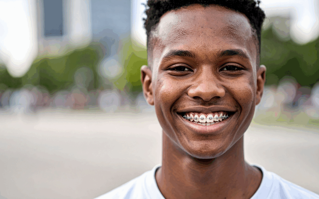 Braces and Sports: Protecting Your Smile During Athletic Activities