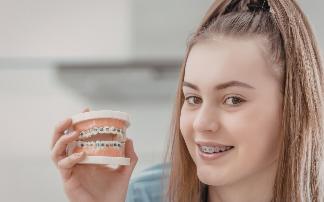 Braces Brackets: Understanding Different Bracket Systems