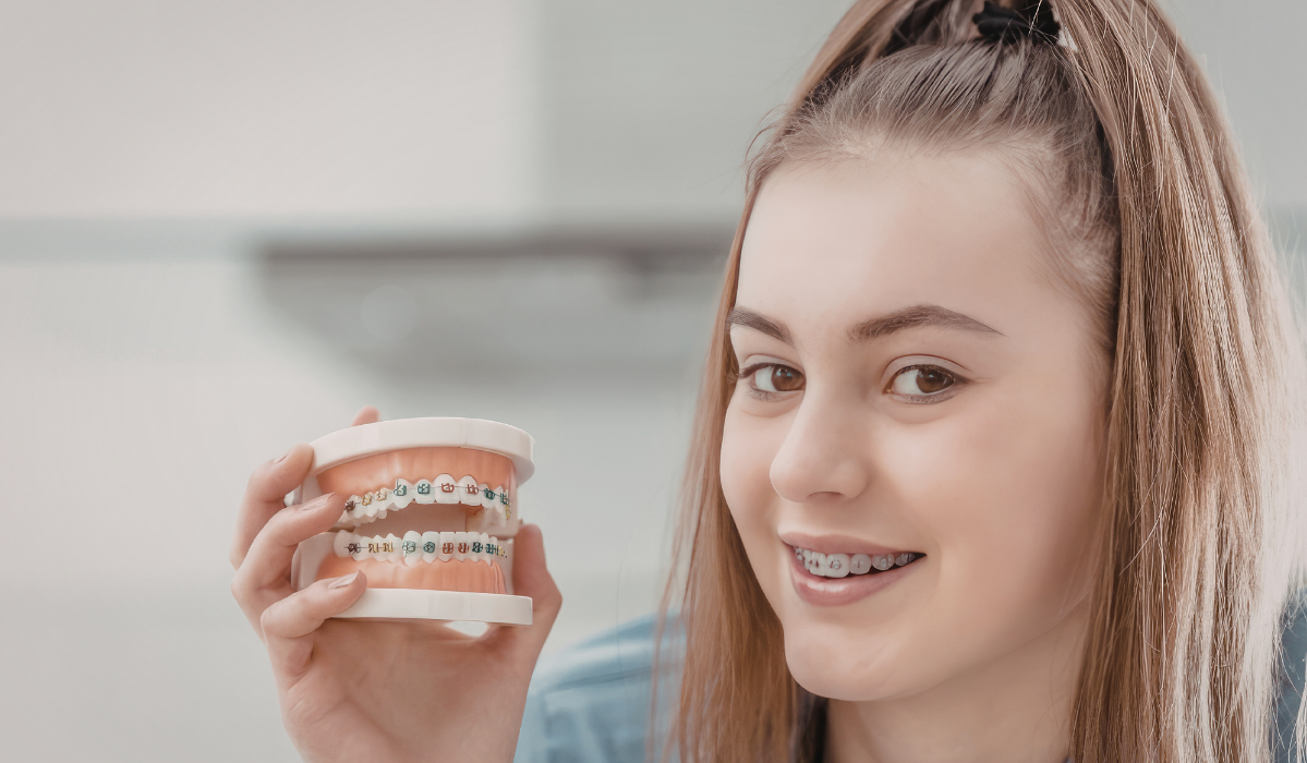 Braces brackets types and bonding process at Dunnville Dentistry